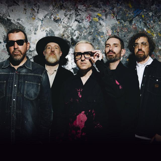 Hot Chip Manchester